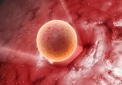 俄羅斯做試管多少錢要準備什么？?